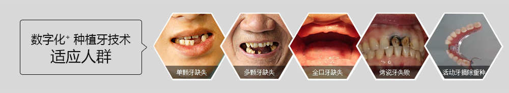 數(shù)字化種植技術(shù)適應(yīng)人群